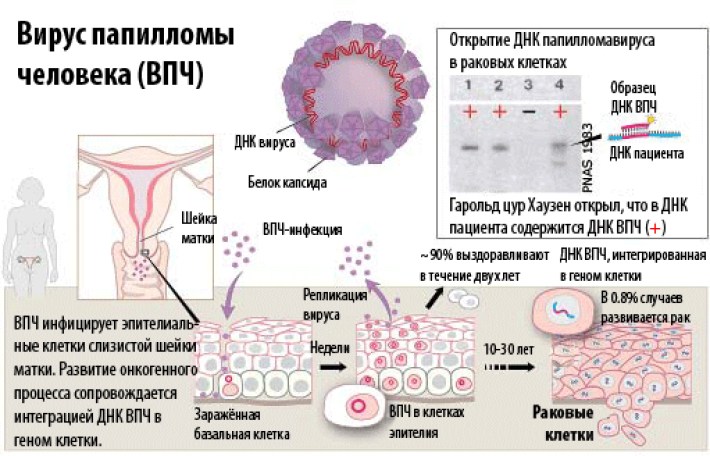 Что женщинам нужно знать о ВПЧ (вирусе папилломы человека)