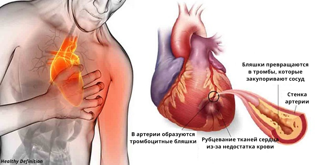 Если вы боитесь сердечного приступа и инсульта, не пейте этот напиток никогда!