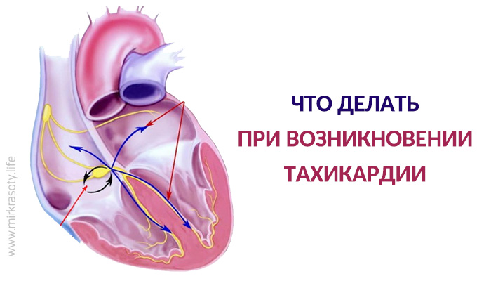 Что делать при возникновении тахикардии?