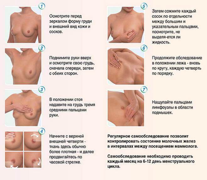 Как провести самостоятельное обследование молочной железы