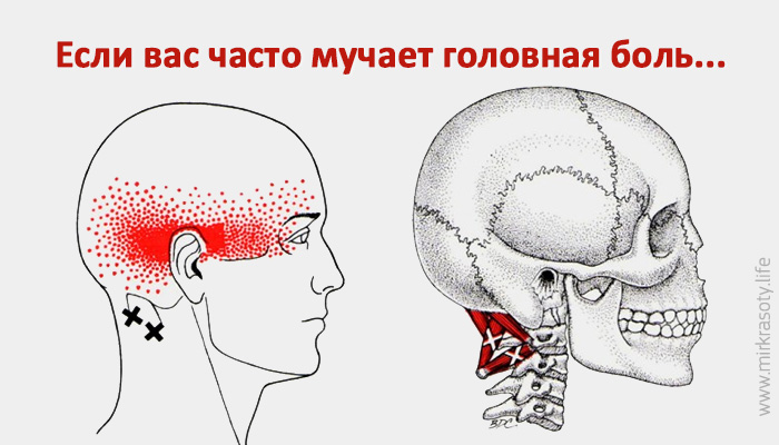 Если вас часто  мучает головная боль…