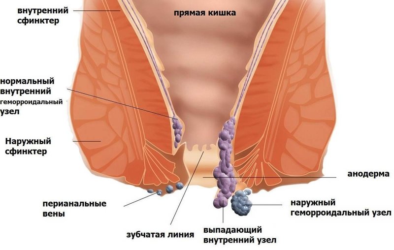 Это упражнение поможет избавиться от геморроя