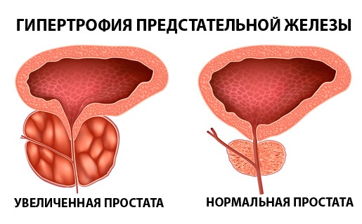 Если вы просыпаетесь по ночам, чтобы сходить в туалет, прочитайте это!