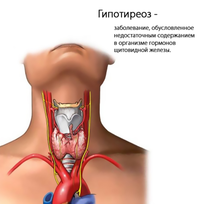 Гипотиреоз: продукты питания, ускоряющие метаболизм