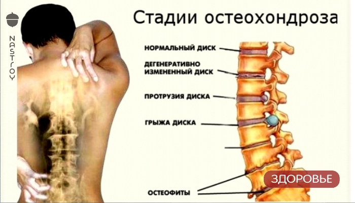 Сенсация! Гимнастика Бутримова нормализует кровообращение и восстановит правильное положение позвонков шеи!