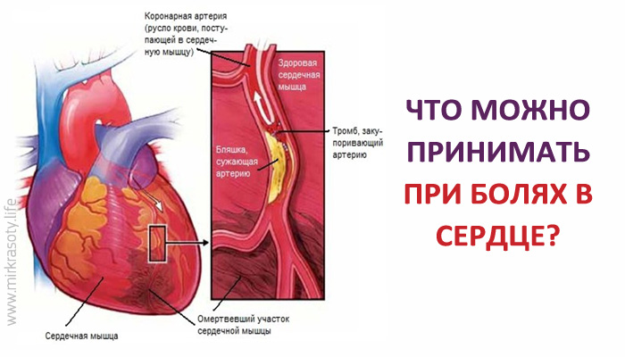 Что принимать при болях в сердце?