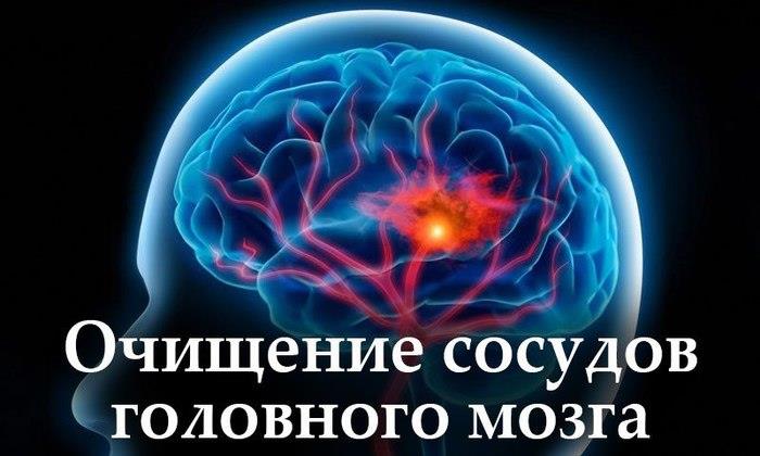 Очищение сосудов головного мозга: 5 лучших народных средств