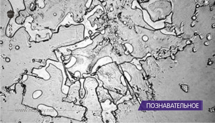 В это трудно поверить: так выглядят слезы под микроскопом!