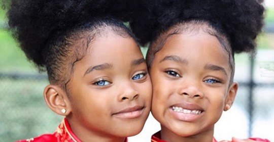 Сестры-близняшки покорили мир своей чарующей красотой. Как выглядят дети спустя 4 года