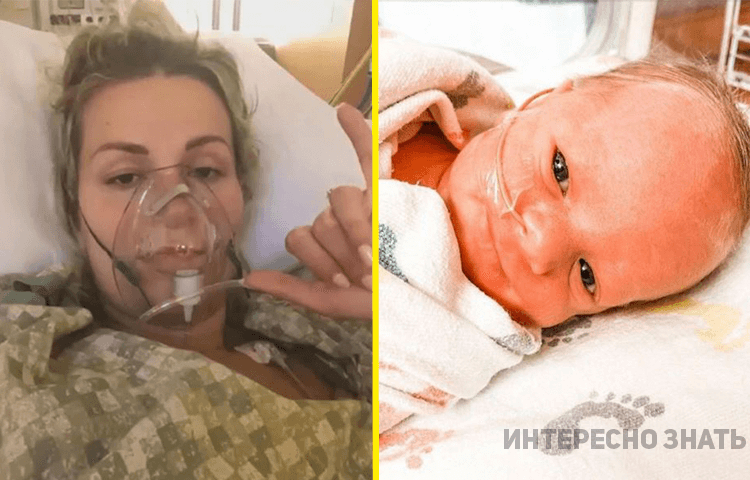 Женщина родила ребенка, пока находилась в коме из-за коронавируса