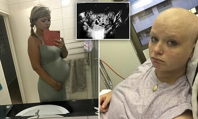Мать 2 детей думала, что снова беременна, в то время как внутри неё росла опухоль