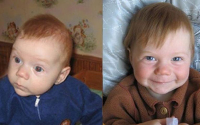 Как же важно быть любимым: Фото детей до и после усыновления