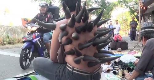 Зачем в Индонезии уличные целители ставят рога на спину пациентам