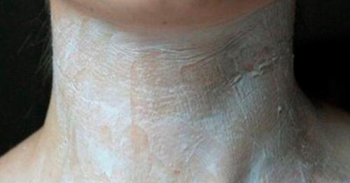 Складки и морщины на шее исчезнут вмиг: 4 суперрецепта