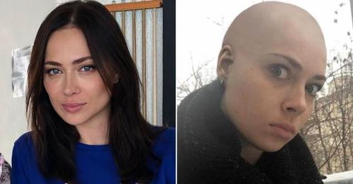 20+ смелых знаменитостей до и после того, как они побрили голову налысо