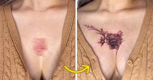 Талантливый тату-мастер перекрывает шрамы на коже своих клиентов, позволив им стереть негативные воспоминания