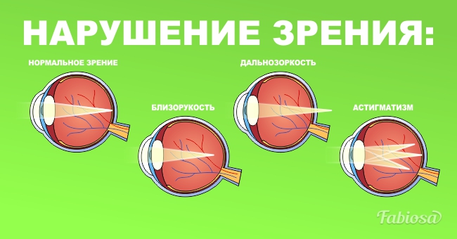 Как распознать симптомы серьёзных глазных болезней и отличить их от естественных возрастных изменений?