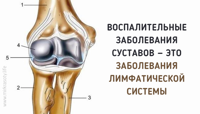 Проблемы с суставами — это заболевания лимфатической системы!