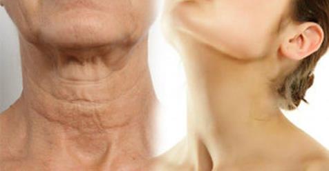 5 простых способов омолодить кожу шеи на 10 лет! Результаты просто поразительные!